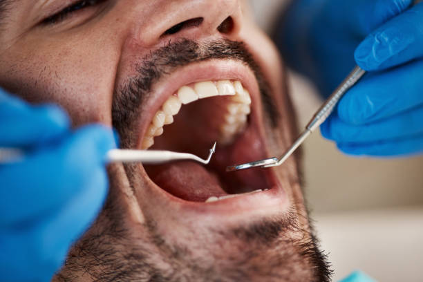 Best Emergency Root Canal Treatment in Manistee, MI
